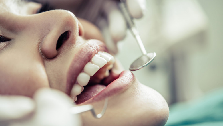 How Milton Dental Care Helps You Smile with Confidence
