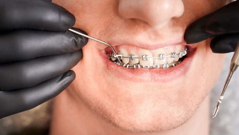 The Growing Importance of Regular Dental Care in Milton