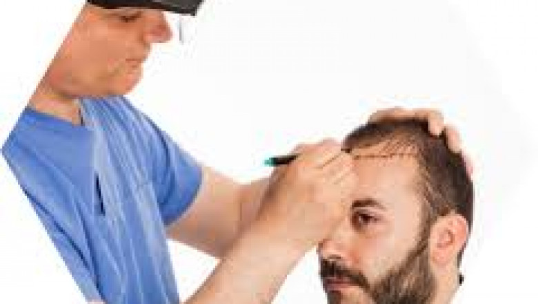 Ultimate Guide to Hair Transplant in Gurgaon & Lucknow: Cost, Clinics & Expert Care