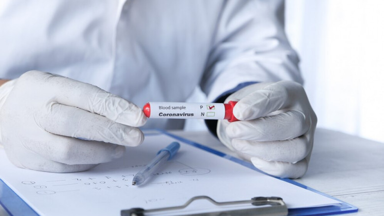 Rapid Test vs. PCR: Key Differences